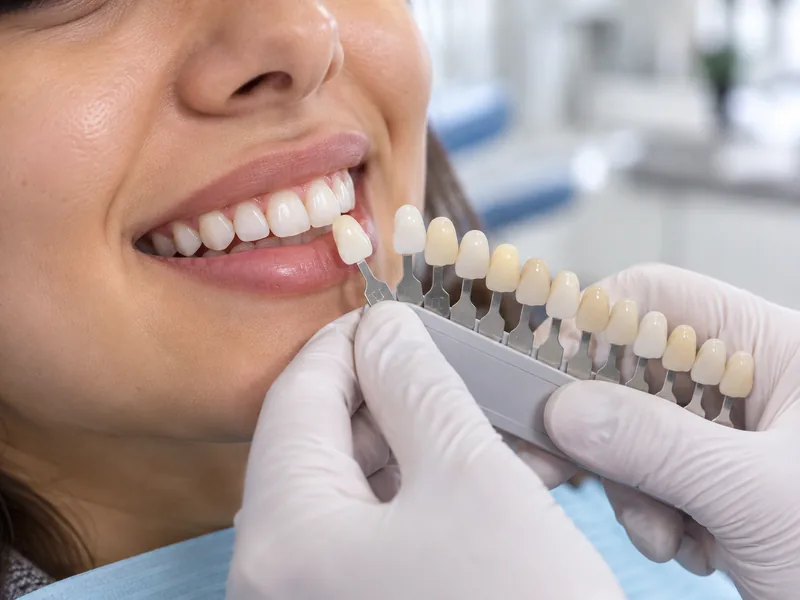 Dental Crowns & Caps at SR Multispecialty Dental Clinic, Gajularamaram